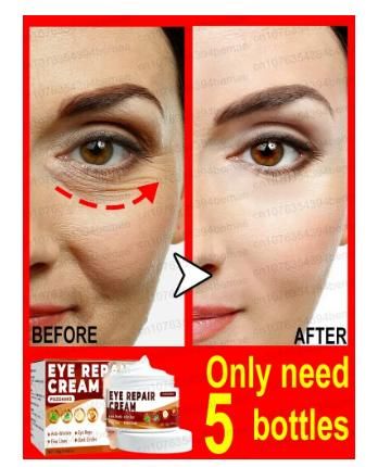 Eye Repair Cream | Nourishing Under Eye Care Formula | 50 gm Each (Pack of 2)